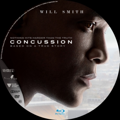 Concussion