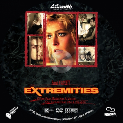 Extremities