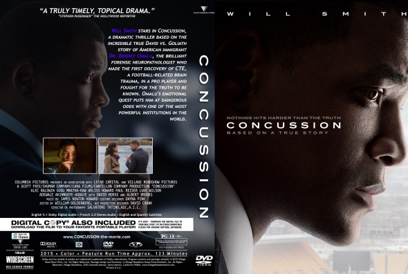 Concussion