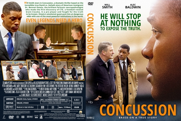 Concussion