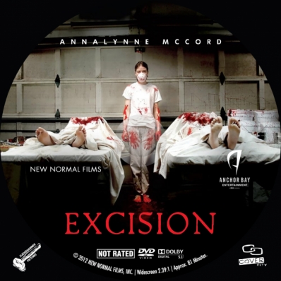 Excision