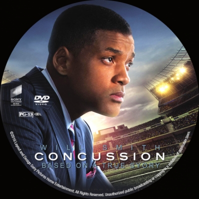 Concussion