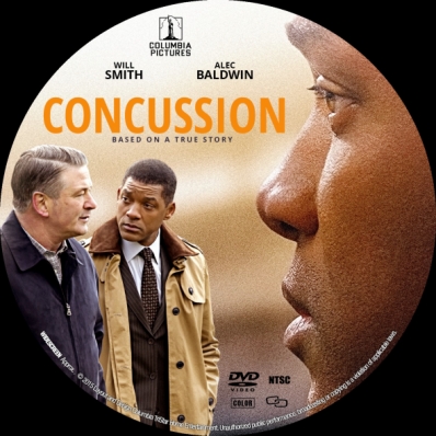 Concussion
